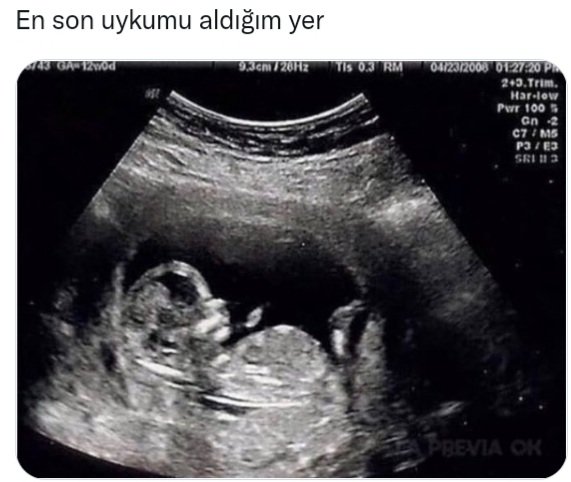 Çoğu insanın gecesi: 🌜🌠🌛

"
▶️ Sıkıntı ve zorlukları nasıl aşarsın..

▶️ Uyurum..😴        
                                            "

Gヅᑎ🌙dın Huzur🌾 #GünaydınGece 🌃