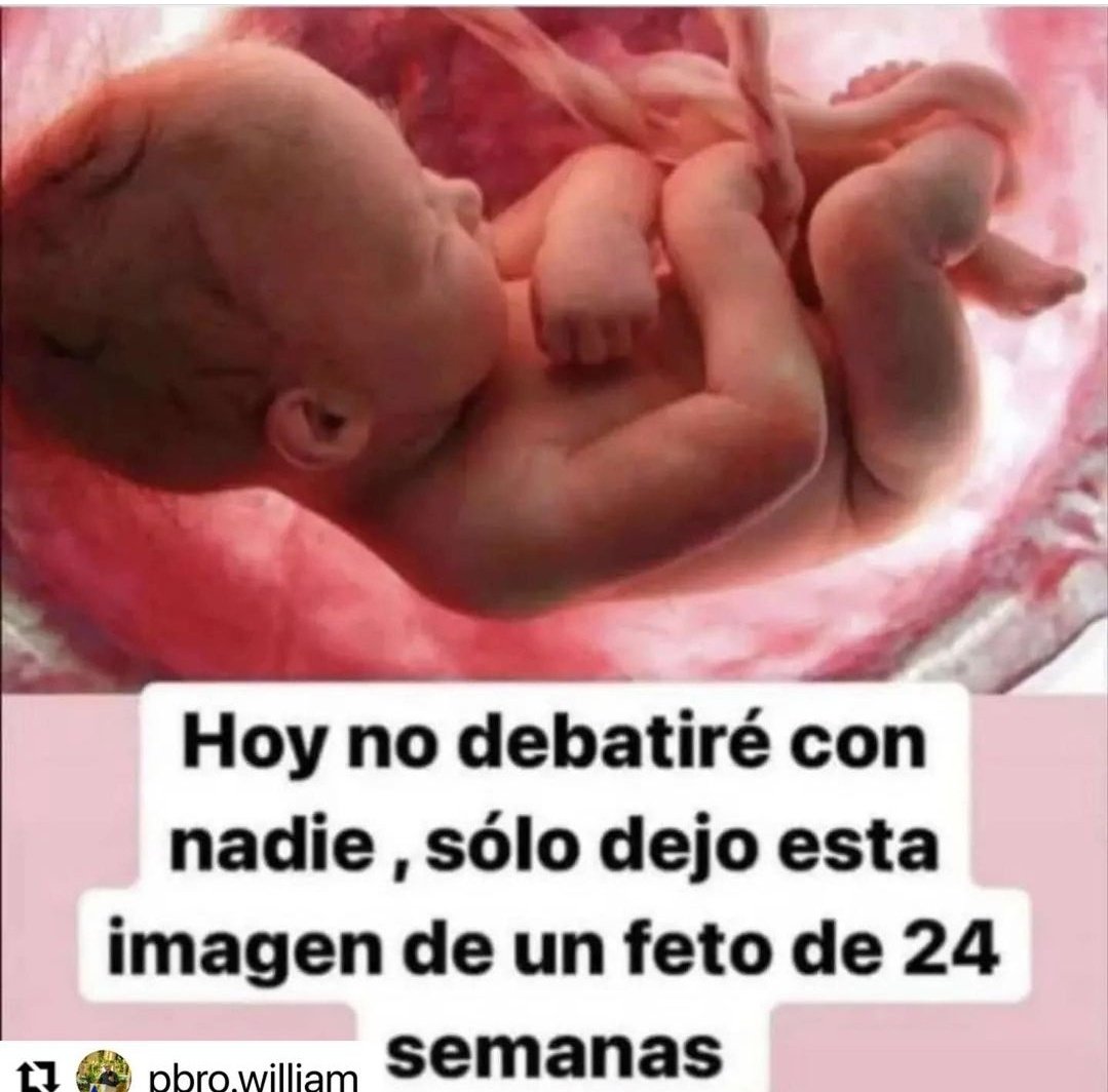 ADRIANAAZZIAS's tweet photo. En Colombia aprobaron legalmente que pueden asesinar a un ser humano en estado de gestación de 6 meses... https://t.co/B8qom73qH4