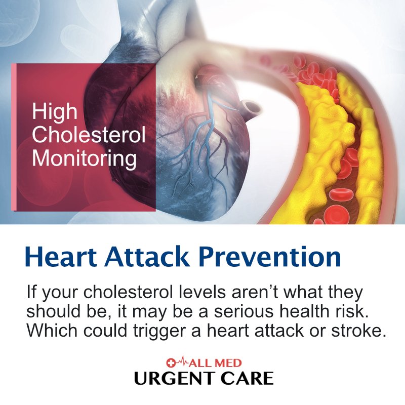 High cholesterol can lead to serious heart problems. Be sure to get yourself checked out regularly for high cholesterol. 

#health #heartproblems #highcholesterol #checkups #hearthealth #doctors #medicine #health #walkinclinics #nyc