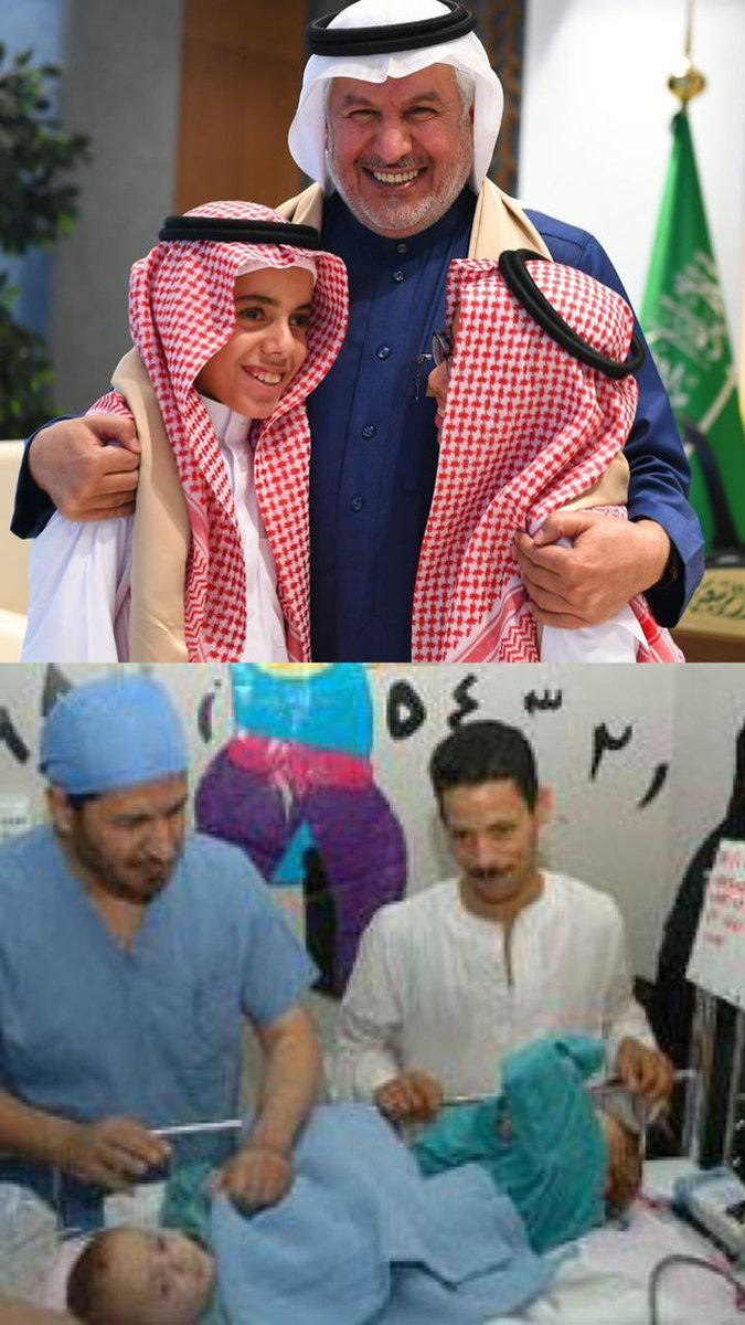 krim237's tweet photo. د. عبدالله الربيعة يلتقي التوأم السيامي المصري حسن ومحمود وذويهم ، اللذين سبق أن أجريت لهما عملية ناجحة لفصل الالتصاقات في الأمعاء والمسالك البولية والتناسلية والحوض بمدينة الملك عبدالعزيز ال��بية للحرس الوطني بالرياض عام 2009 م. https://t.co/gP0oldemU8