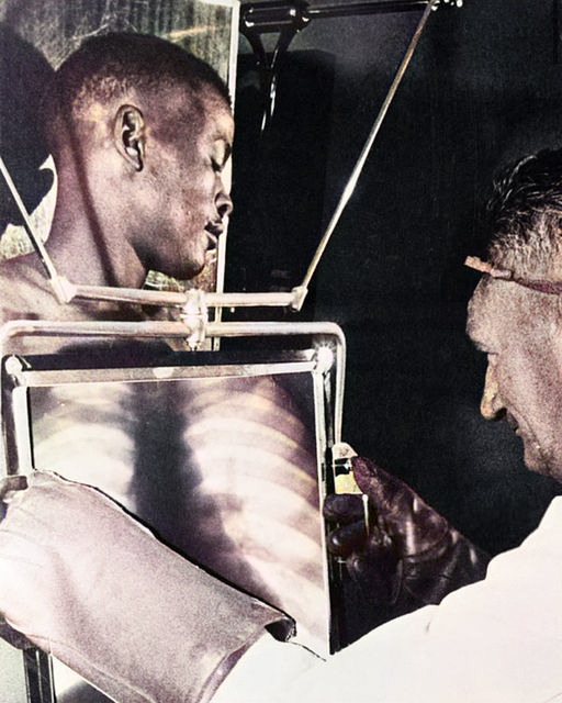 South African mine workers were x-rayed by radiologists at the end of each shift before leaving the De Beers diamond mines in Kimberley, South Africa, 1954.
