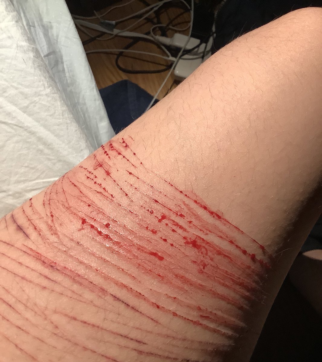 albedosalliums's tweet photo. tw // sh , cat scratches 
.
.
.
.
.
.
.
yikes sh in the dark is messy https://t.co/tk7toTUN9a