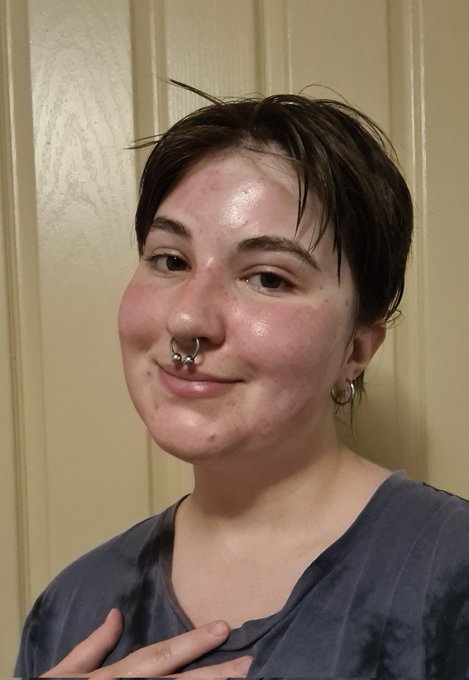 Tried to do a little "self care" and I guess I'm allergic to this face mask https://t.co/YRrelvu8KJ
