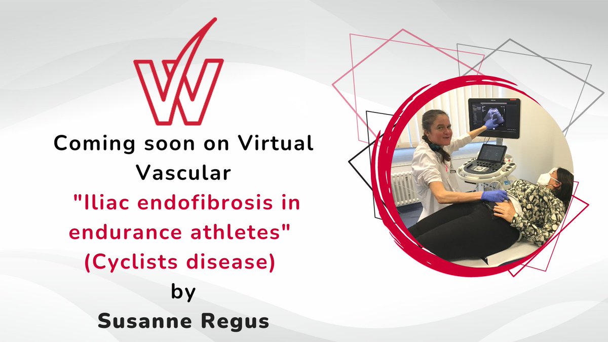 VirtualVascular's tweet photo. Watch this space! New chapter coming soon on Virtual Vascular. Don't have access to the e-library including Virtual Vascular yet? Become an ESVS member or subscribe to an e-library free trial period. Learn more: https://t.co/yq361h3LyM @JJEarnshaw @petarz_91 @VenerMa https://t.co/qz2CPxXpz9