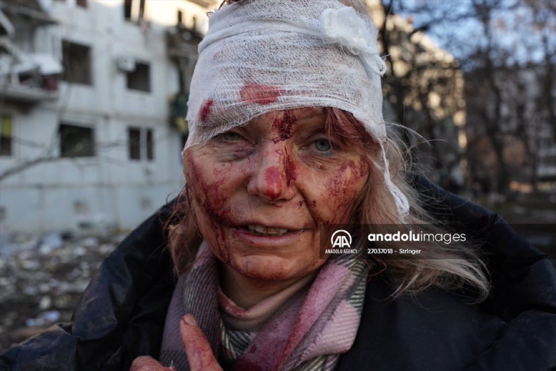 solcugazete's tweet photo. Kharkiv yakınlarında, Anadolu Ajansı tarafından çekilmiş fotoğraflar; https://t.co/FkJTY6FtmA