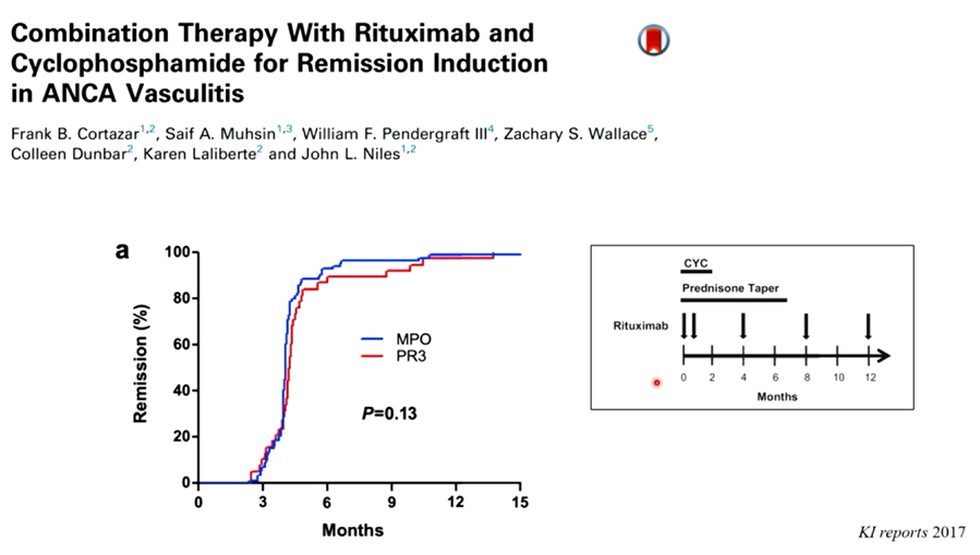 BasuNephro's tweet photo. #ISNWCN David Jayne #ANCA #vasculitis #Rituximab works relatively slowly – while initial Steroid + CYC may have rapid effect. For Severe disease: #Ritux #combination with #Cyclophosphamide - better results with #steroid #minimization – but needs confirmed in a large trial
4/7 https://t.co/AfJnehb3UL