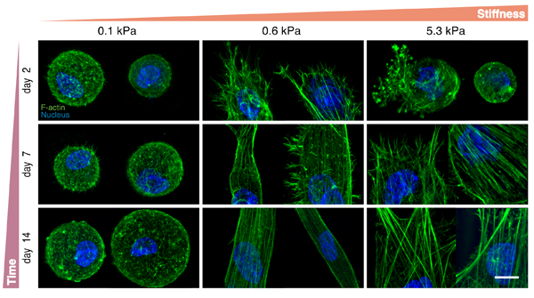 A hydrogel model is developed to allow researchers to independently study the impact of matrix stiffness and degradability on cell behavior.

<a href="/MPI_Muenster/">MPI Molecular Biomedicine</a> <a href="/BakerLaboratory/">Baker Lab</a> <a href="/UMBME/">U-M BME</a>  

Read the article: ow.ly/a3yJ50I31Rc