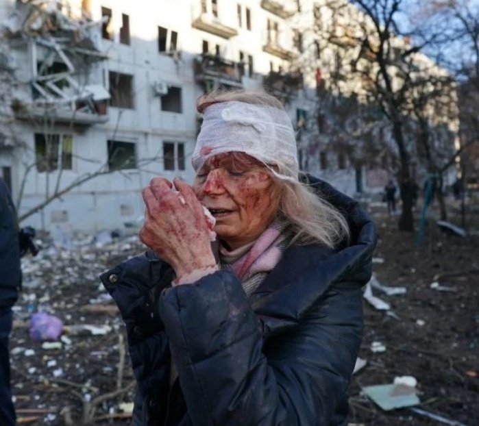jgsanguineto's tweet photo. A #pazmundial tá longe de acontecer, enquanto Rússia, Estados Unidos, China e OTAN não se entenderem nesse ataque a Ucrânia, essas são as imagens que ficam, o sofrimento do povo! https://t.co/caMDZvkV2S