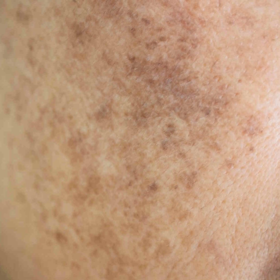 msbb_id's tweet photo. "Min, cara ngatasin dark spot/bekas jerawat supaya tampilannya lebih sopan gimana ya?”

Oke, kali ini mimin peri bakal berbagi tips untuk membantu permasalahan dark spot sekaligus rekomendasi produk racunnya🧚🏻‍♀️

Simak thread ini sampai selesai ya!😉 https://t.co/yj56gYg3gr