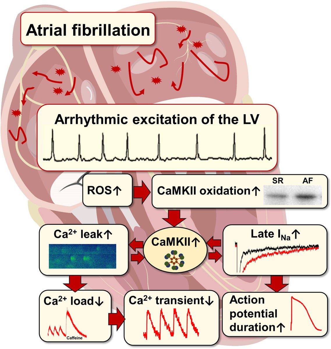 Samuel Sossalla (@samuelsossalla) on Twitter photo "The effects of AF on human ventricular function"
Thanks for fantastic teamwork
Even normofrequent AF causes LV remodeling
Rhythm control first
ahajournals.org/doi/10.1161/CI…
<a href="/AGEP_DGK/">AGEP</a> <a href="/HRSonline/">Heart Rhythm Society</a> <a href="/DGK_org/">Deutsche Gesellschaft für Kardiologie</a> <a href="/Barbara_Casadei/">Barbara Casadei</a> <a href="/nmarrouche/">Nassir Marrouche</a> <a href="/CircRes/">Circulation Research</a> <a href="/chris_sohns/">Christian Sohns</a> <a href="/niels_voigt/">Niels Voigt</a> <a href="/JordiHeijman/">Jordi Heijman</a> "The effects of AF on human ventricular function"
Thanks for fantastic teamwork
Even normofrequent AF causes LV remodeling
Rhythm control first
ahajournals.org/doi/10.1161/CI…
<a href="/AGEP_DGK/">AGEP</a> <a href="/HRSonline/">Heart Rhythm Society</a> <a href="/DGK_org/">Deutsche Gesellschaft für Kardiologie</a> <a href="/Barbara_Casadei/">Barbara Casadei</a> <a href="/nmarrouche/">Nassir Marrouche</a> <a href="/CircRes/">Circulation Research</a> <a href="/chris_sohns/">Christian Sohns</a> <a href="/niels_voigt/">Niels Voigt</a> <a href="/JordiHeijman/">Jordi Heijman</a>