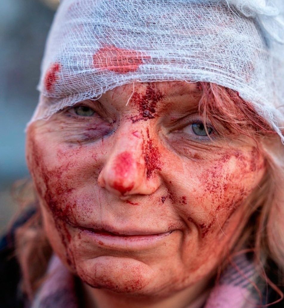 keynercelisc's tweet photo. Cuánto dolor me causa ver lo que sucede en #Ukraine en este momento cuando las tropas de #Rusia pisan la soberanía de un pueblo e invaden por las ambiciones de #Putin 
Nos unimos al sufrimiento de los ciudadanos que han perdido a sus familiares, su vivienda, todo.
Dios Los Cuide https://t.co/CpJMMMabYt