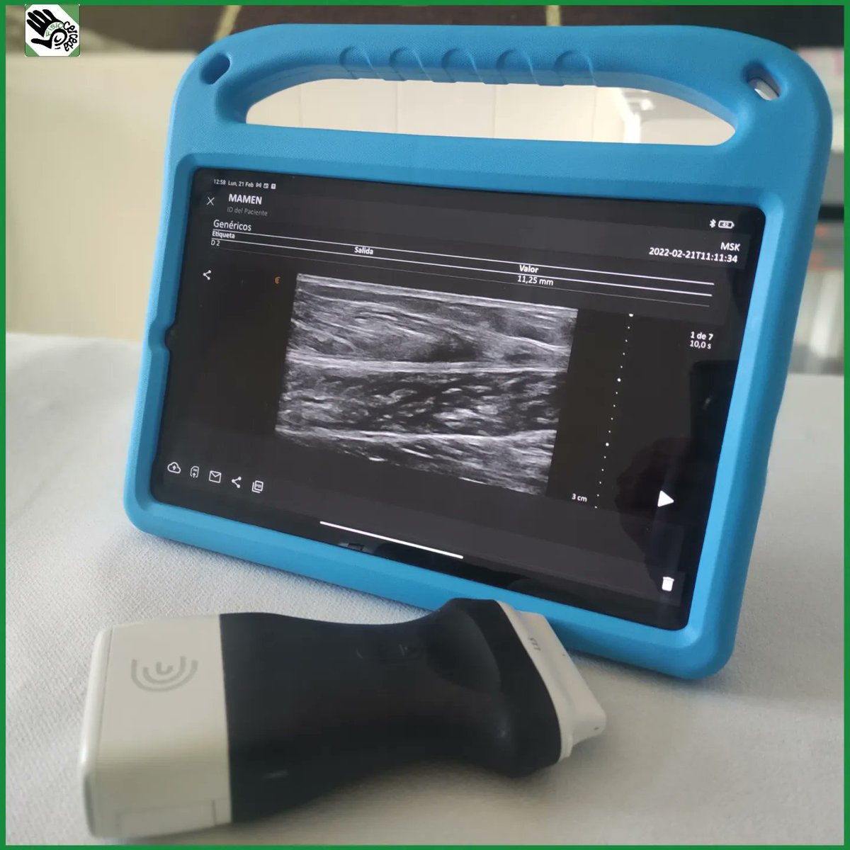 fisiocerceda's tweet photo. Encantados con la calidad de imagen y la versatilidad que nos ofrece nuestro nuevo ecógrafo @clariusmhealth 👌.

https://t.co/XlAPNqWx5r

#Fisiocerceda #ecografia #ecografo #clariusultrasound #clarius #elboalo #madrid https://t.co/Y4DSmymkPy