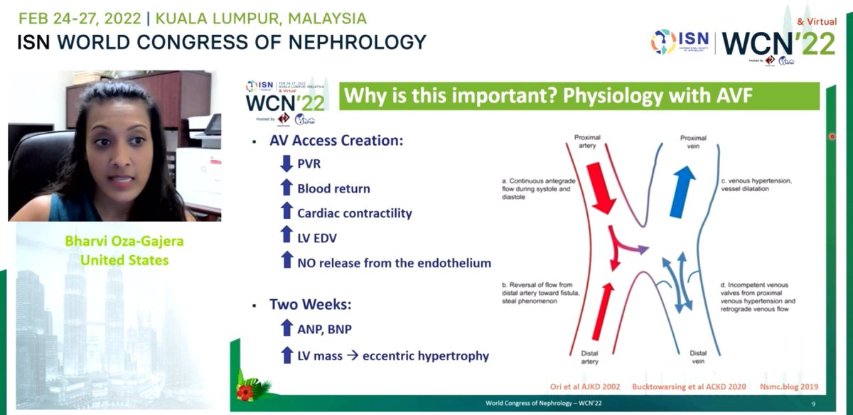 Renaladdict's tweet photo. When and How to Manage High Flow Fistulas by speaker Bharvi Oza-Gajera #ISNWCN @ISNkidneycare @bharvioza SV is a function of PVR, AV access creation changes this dynamic https://t.co/8pC5LlrdsH