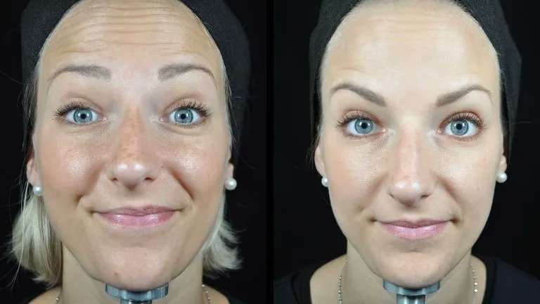 HealthistaTV's tweet image. The new Baby Botox – this is exactly what happens to your face
buff.ly/3heqOuw #antiaging @Medicetics @AliceHartDavis