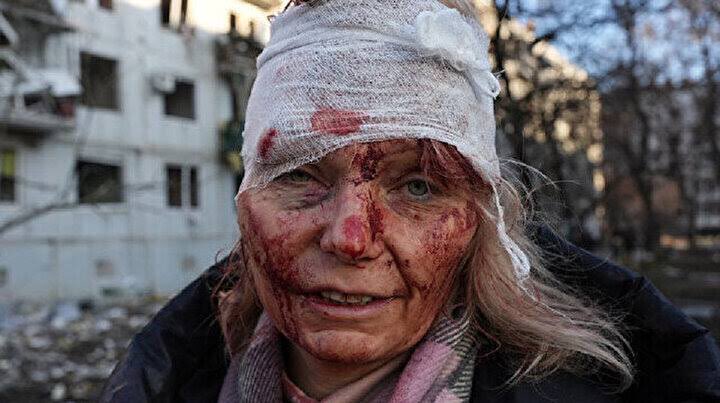 “ İnsanların öldüğü hiçbir dava haklı değildir.”
#Ukrainian #Russia