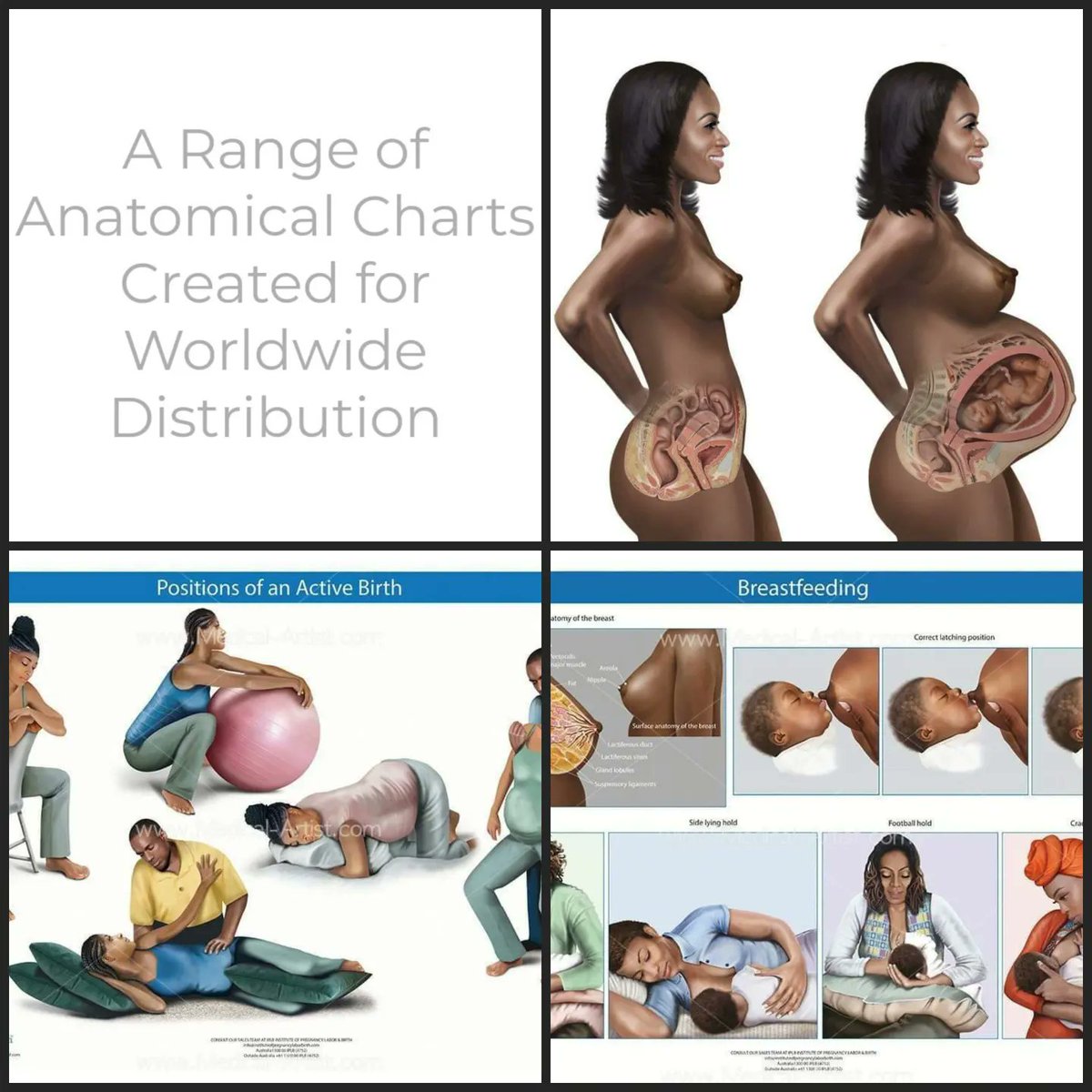 One of my wonderful followers let me know about this beautiful series of anatomical charts on parents of color. They were created as a collaboration between Ghanaian-Australian nurse @ladylindaadu and medical illustrator @joannaculley. medical-artist.com/portfolio/anat… #obgyntwitter
