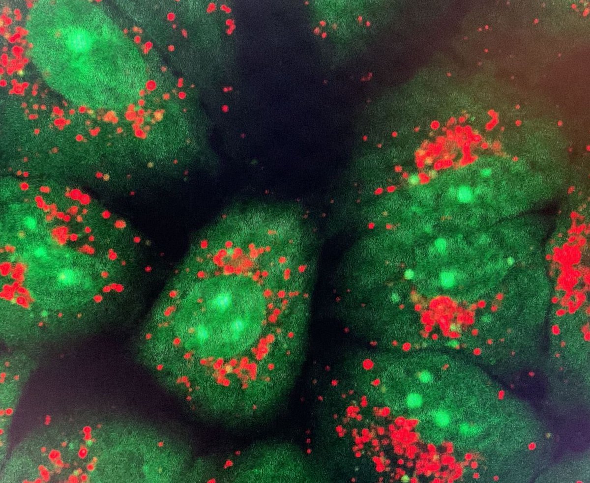 When you have great scientists like @AnnaMassaguer1 in the lab, no technique can resist: check out these spectacular fluorescence images! In green, the cell nucleus, the lysosomes in red.

#PDT #CancerResearch #fluorescenceimaging