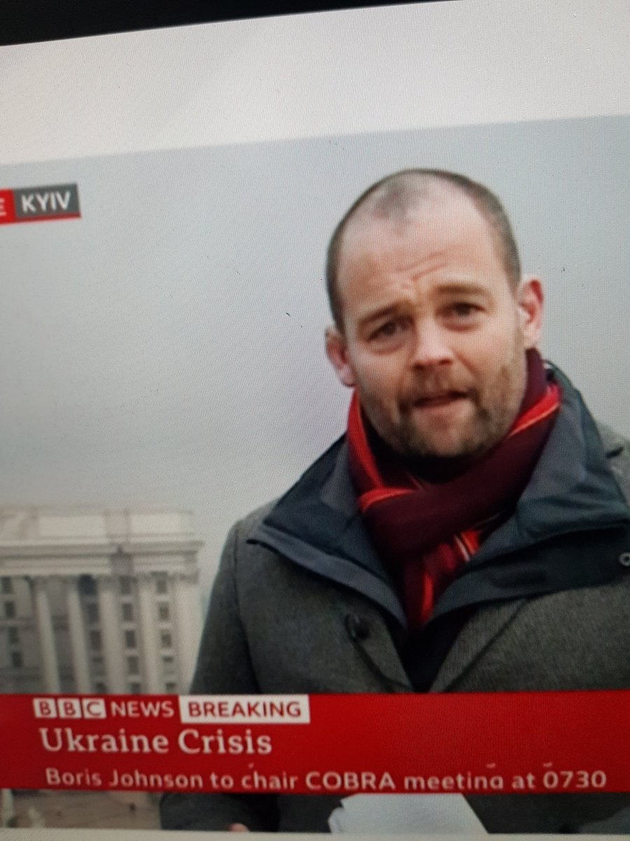 Do u see what I see on Jame's forehead? Definitely and hopefully not the 3rd WW.