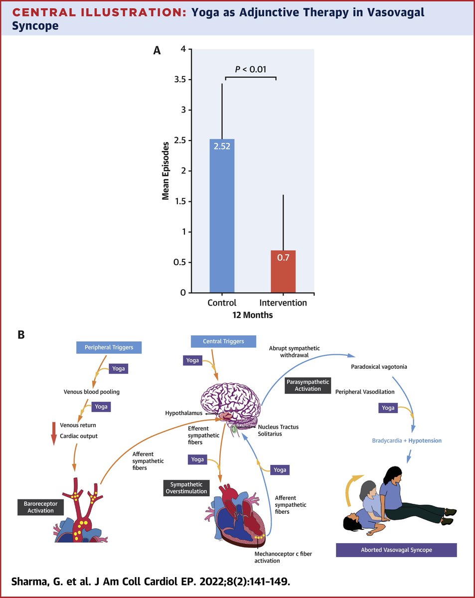 JACCJournals's tweet photo. New issue of #JACCCEP is out!

Did you know that #yoga as adjunctive therapy is *superior* to standard therapy alone in reducing symptoms &amp; improving #QoL in pts w/ recurrent vasovagal #syncope?

Read the LIVE-YOGA study: https://t.co/VKVQE4y9Iz #IntergrativeHealth #CardioTwitter https://t.co/at8lWnT1qL