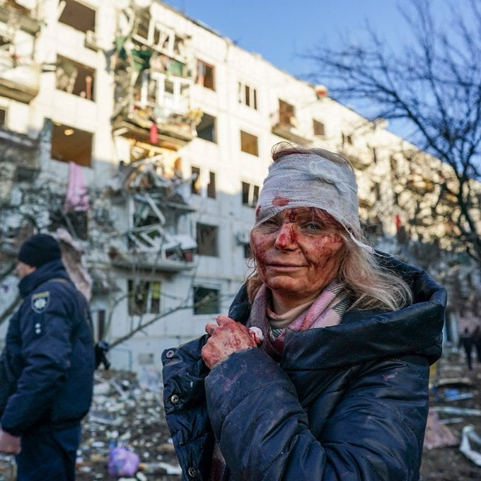 JamesTate121's tweet photo. Hey Fox News & Republicans, remember this image. Remember today Feb 24th 2022. Remember those who appeased Putin. Remember the day Russia bombed Europe. Town of Chuhuiv, near Kharkiv in eastern Ukraine. This is the carnage you create!😢
#UkraineRussiaCrisis 🇺🇦
#BlueVoices📢📢📢 https://t.co/MABUbQXbhF