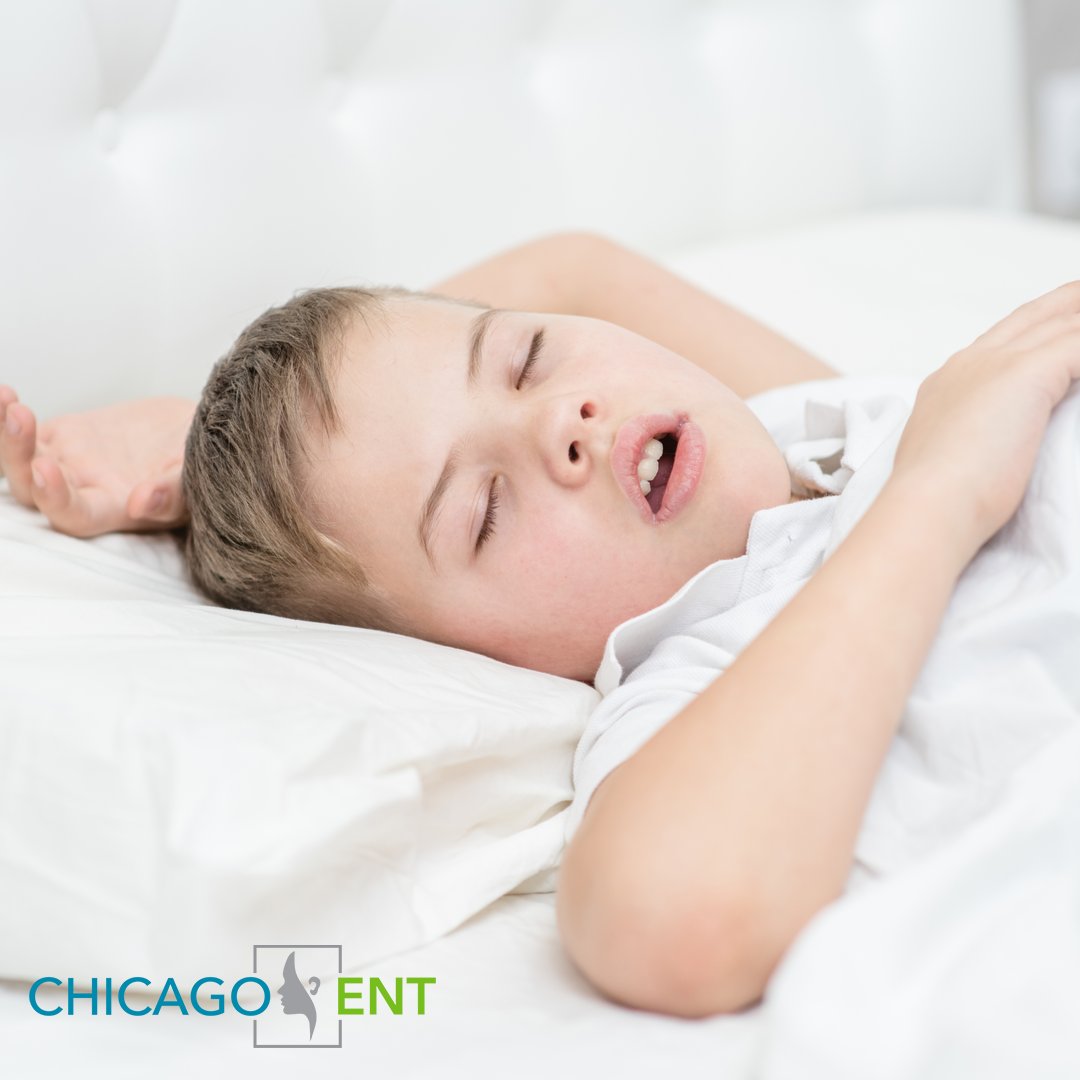 Chicago_ENT's tweet photo. #DidYouKnow that sleep apnea can manifest itself in anyone of any age, even children? 

If your child is snoring you may want to have them see a sleep specialist and make sure it is not pediatric sleep apnea. 

Schedule an appointment with Chicago ENT today to get started. https://t.co/H3idhpRa2a