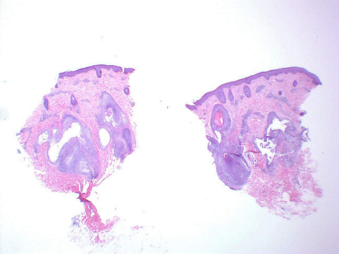 GeronimoJrLapac's tweet photo. F, 30yo
#dermpath #pathology https://t.co/pyjrDL2Yds