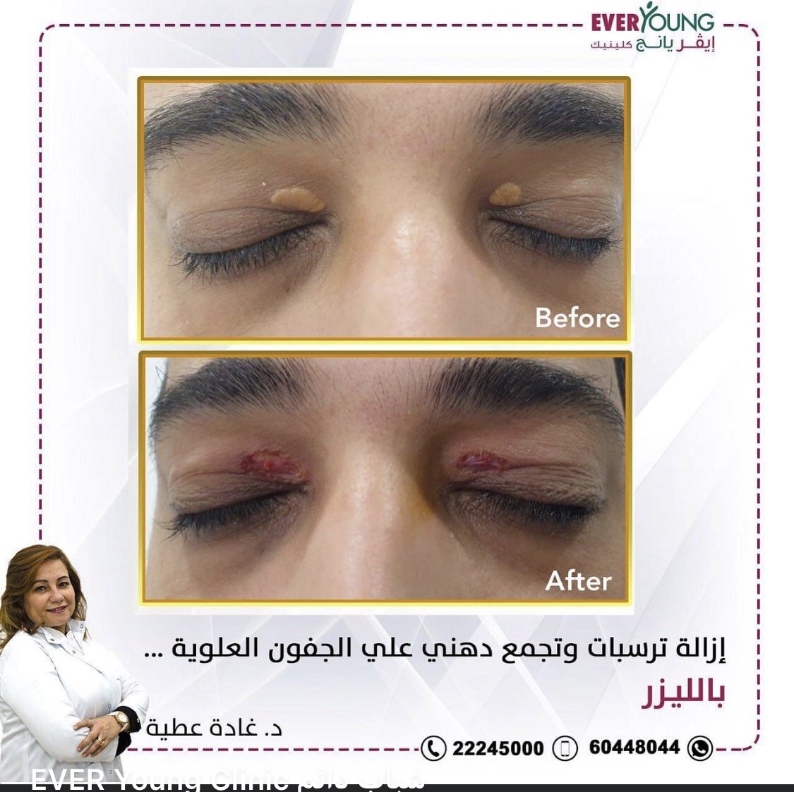 <a href="/_AskJeddah_/">أسال جدة</a> هل يوجد عياده في جده تقوم بنفس الشيء