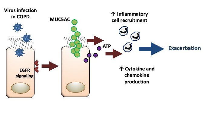 SinganayagamLab's tweet photo. Excited to share our new paper defining roles for airway mucins in driving immunopathology during virus-exacerbated #COPD now online @jclinicalinvest. @ImperialInfect @ImperialNHLI
https://t.co/NNTxUuAu92
Thanks to funders @BlfResearch @BMAFoundationMR https://t.co/jvNBfn3AHf