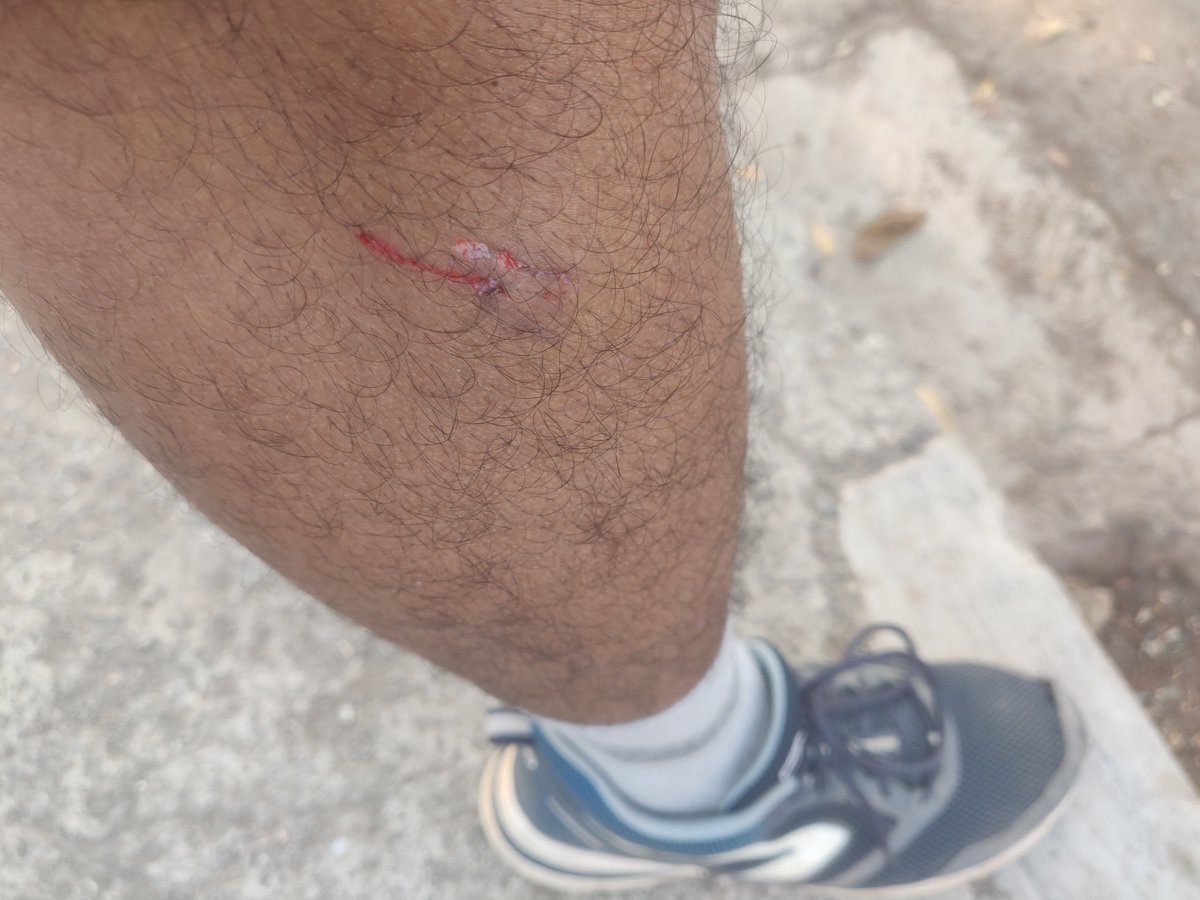 KforKush's tweet photo. @mybmc @MCGM_BMC @mumbaimatterz  Multiple stray dogs at Powai lakefront walk area biting d walkers n joggers, many instance noticed.
Today morning even I got a bit while walking back
Requesting concerned authority to take necessary action asap to avoid risks to kids n sr citizens https://t.co/XYNqpNEXh5