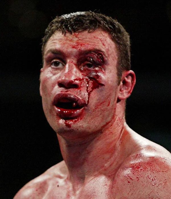 MatthewAguilar5's tweet photo. When Mayor Klitschko and his brother say they’re ready to fight, I believe them. https://t.co/HcsU4CKTOo