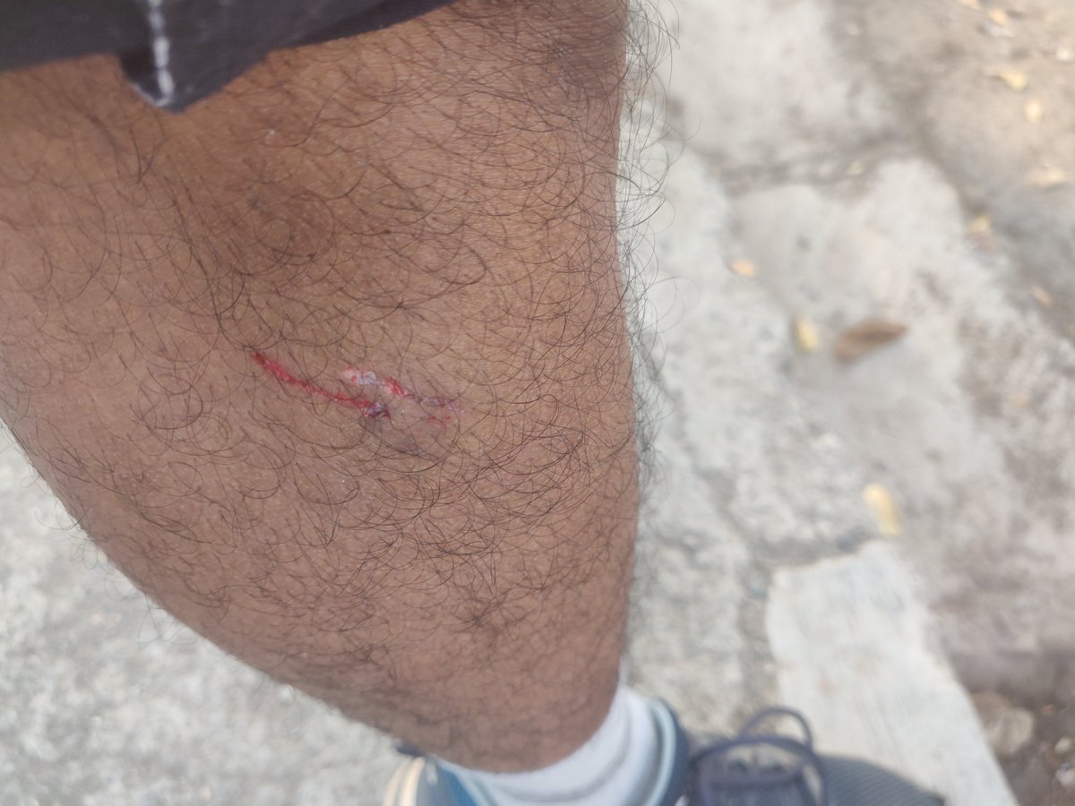 KforKush's tweet photo. @mybmc @MCGM_BMC @mumbaimatterz  Multiple stray dogs at Powai lakefront walk area biting d walkers n joggers, many instance noticed.
Today morning even I got a bit while walking back
Requesting concerned authority to take necessary action asap to avoid risks to kids n sr citizens https://t.co/XYNqpNEXh5