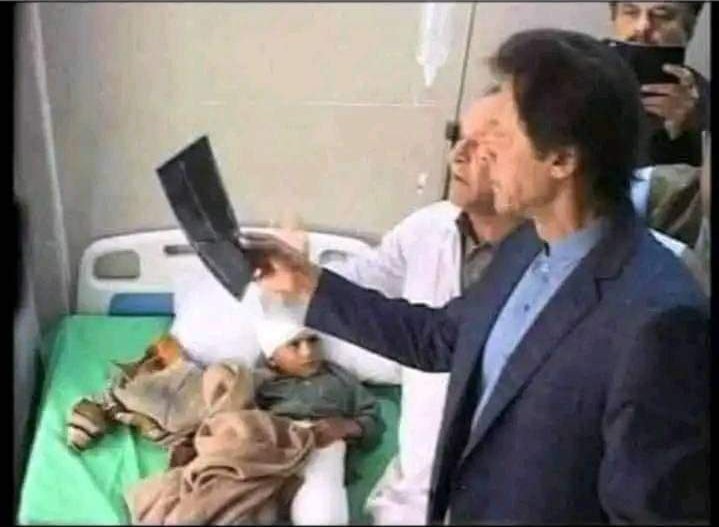 abynikalna's tweet photo. Mujy X-ray Mai Is Bachy Ki Kmeez Ki Side Vali Jaib Mai 300 Rupy Nzar A Rahy Hen 
Doctor Is Sy Chanda Mango: https://t.co/cmow7SbuTS