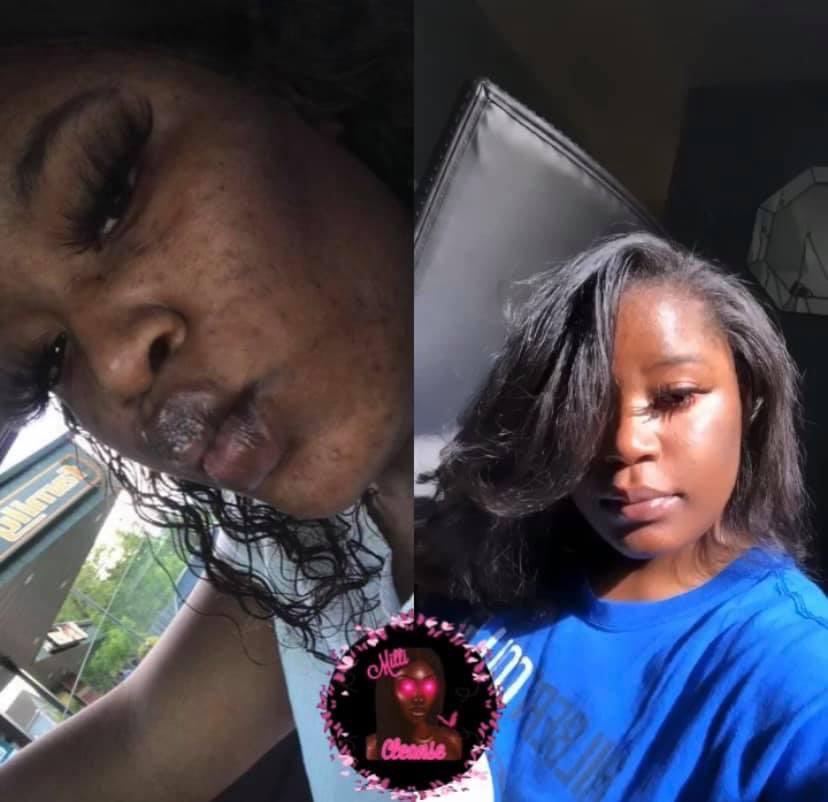 MilliCleanse's tweet photo. @AriTheDon Troubled Acne? Hyperpigmentation? Acne scarring? Looking for a overall skincare routine? Shop Milli Cleanse, 50% off this whole month 🌿🤎✨ ALL NATURAL &amp; BLACK OWNED https://t.co/q75G3FZQ89 https://t.co/kkcf27YsjE