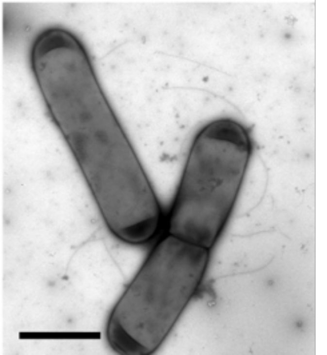 BugS_layers's tweet photo. 4. Using #electroncrystallography, we imaged S-layer ghosts, empty capsules of intact S-layer from the #Cdiff cells, to reconstruct a model of the assembled #BugSlayer #SlayerStructure 6/n https://t.co/v1Rrip2Yy1