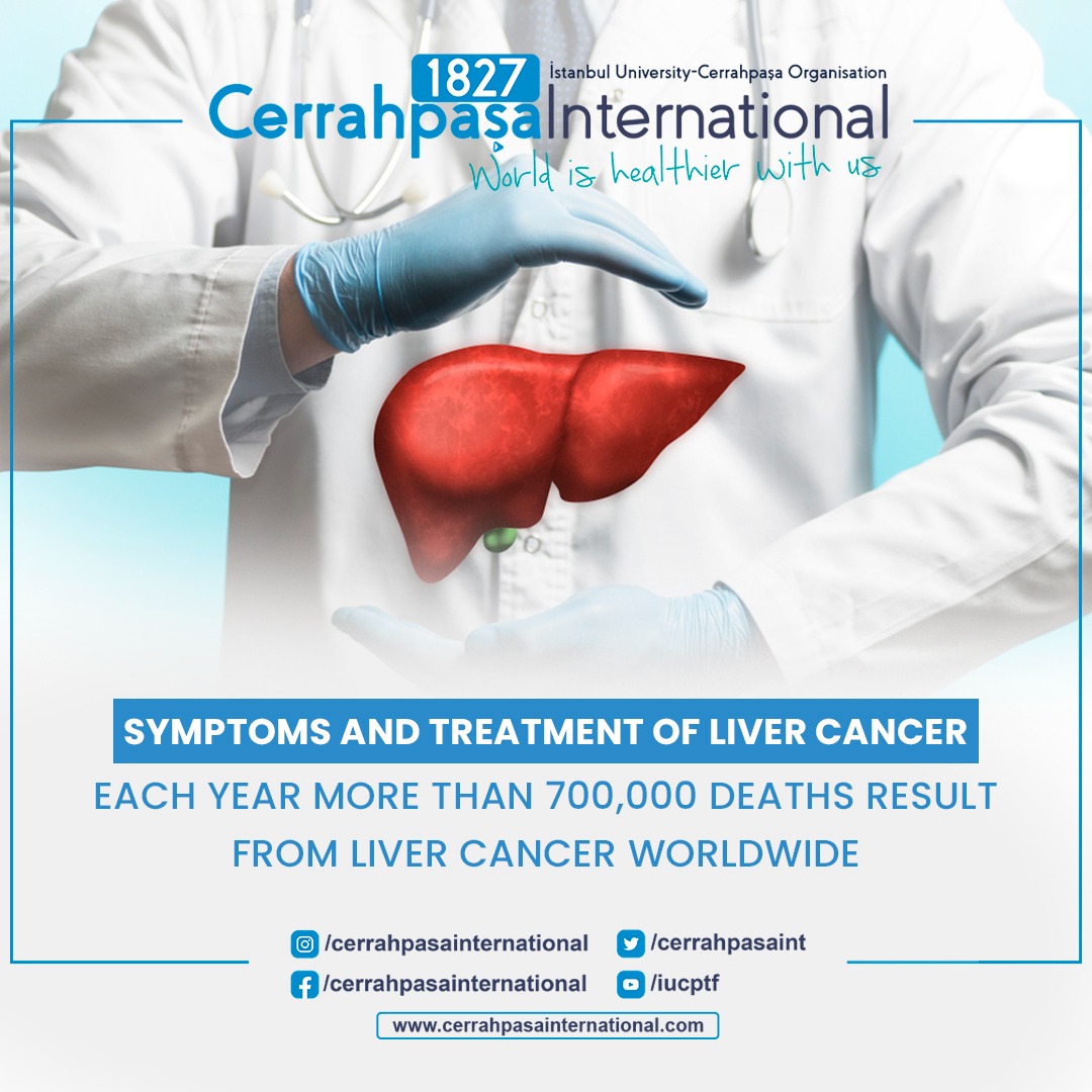 cerrahpasaint's tweet photo. Though it is a leading cause of cancer deaths worldwide, early diagnosis of liver cancer is not easy since the symptoms often don't appear until the later stages.

#cerrahpaşatıpfakültesi #cerrahpaşainternational #cerrahpaşaonlinedoctor
#livercancer #cancersurgery #cancer https://t.co/zIN1vMXLfi