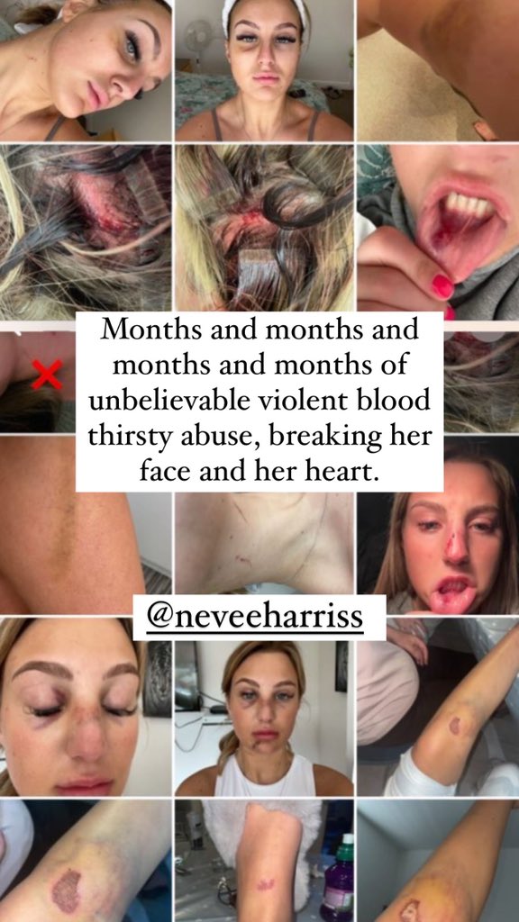 _blxnde's tweet photo. ABUSE is ABUSE! When a narcissist cannot control you anymore they’ll try to control other peoples perspective!  Sam Boyle is a 23 year old psychopath. @neveeharriss1 https://t.co/14Y3MvzX7Q