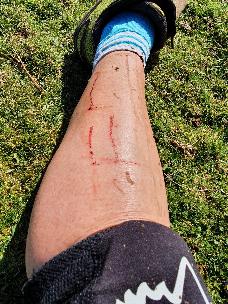 ProfDiCrone's tweet photo. Fab day off ride on a beautiful day... #goodtobealive decided on shorts but brambles out to ruin that! Otherwise fabulous #lovethediff #FeelGoodFriday https://t.co/QuIBXBf5Yn