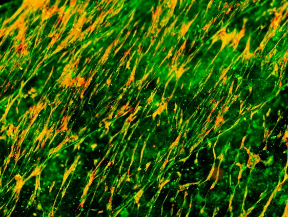 TFlanaganLab's tweet photo. Well done to final year #BHLS student, Tara Fay, on submitting her research thesis today!
Tara took this really neat #opensource biaxial tissue stretcher from Shiwarski et al (https://t.co/pzJ5fpKhxA) &amp; re-purposed it to look at stretch effects on cultured cells (all for <€300!) https://t.co/lv2SzMLLKR