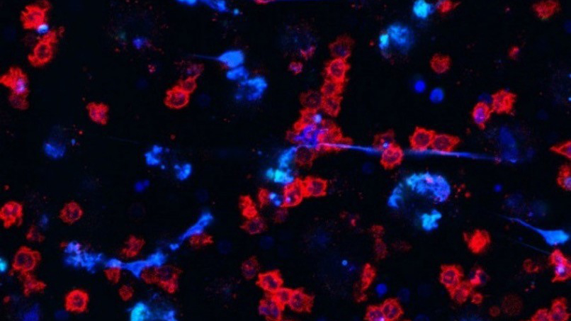 UnimedizinMainz's tweet image. Neue Erkenntnisse zur Entstehung von Autoimmunerkrankungen von unserer Immunologie in @NatureComms veröffentlicht 👉 unimedizin-mainz.de/presse/pressem… #Forschung #Mainz #RLP