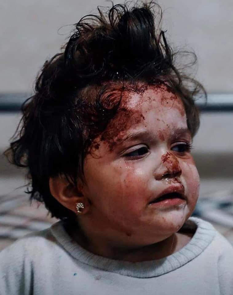 kisan_putri's tweet photo. The saddest thing in any war is the pictures of children💔

#Kiev 
#Ukraine 
#RussiaUkraineWar 
#StopRussia ✋🏻 https://t.co/JvloQ2Z9hj