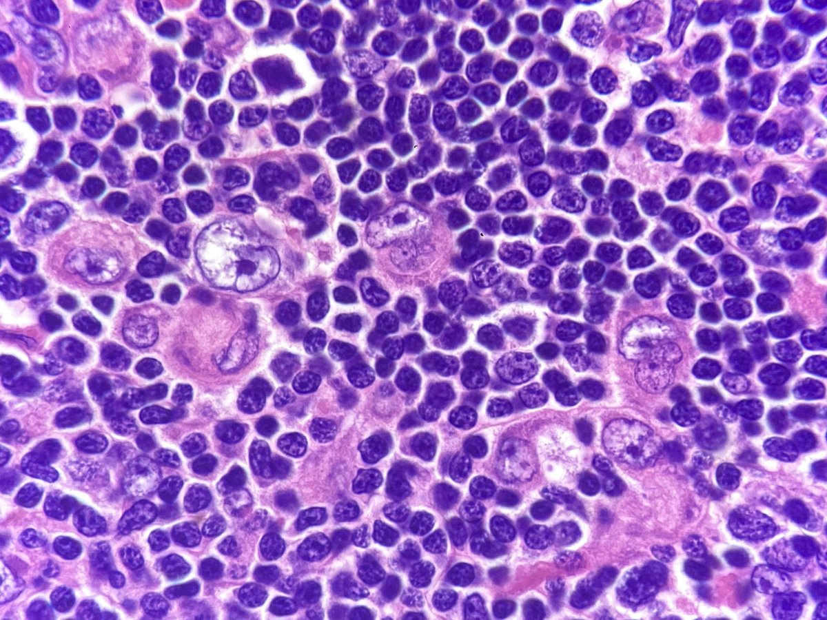 Lucas Massoth, M.D. tweet media