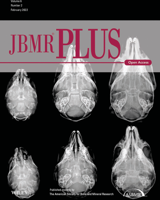 New in #JBMRPlus: Asian Ethnicity and Femoral Geometry in Atypical Femur Fractures: Independent or Interdependent Risk Factors? #openaccess #freetoread #ASBMR <a href="/AlbertEndoc/">Albert Kim</a> <a href="/Gareth_AUS/">Gareth Crouch</a> ow.ly/wOzX50I1w0n