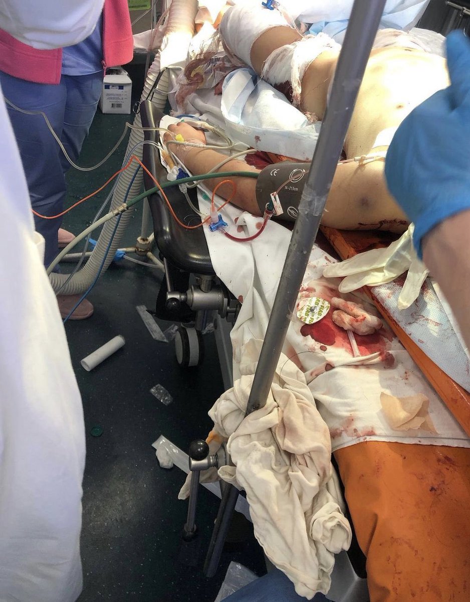 Stand_4Ukraine's tweet photo. Only military targets? Ukranian civil population including children, are been attacked rigth now #Ukranie #OTAN #URGENT https://t.co/CVzRexnNKX