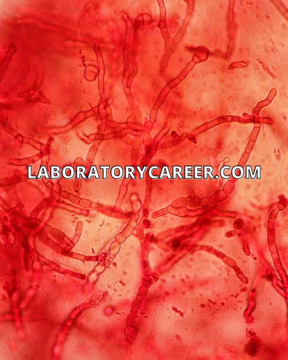 lab_career's tweet photo. HAPPY FUNGAL FRIDAY :) This fungi usually seen in molds has septate hyphae that absorb nutrients from the environment. Want to work under the scope with these fungi? https://t.co/Ww0HMmHiVA #microbiology #laboratorycareer #lablife #sciencerocks #microscope #sciencemajor https://t.co/kuXFeOs0UI