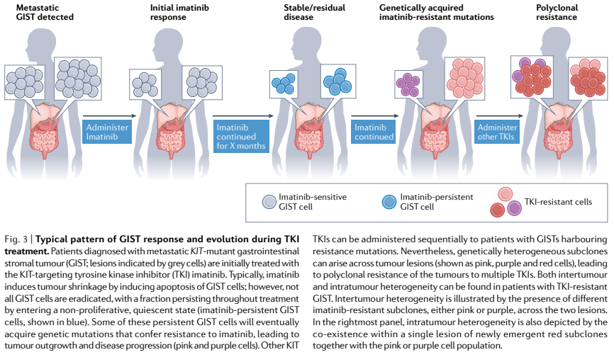 NatRevClinOncol's tweet photo. In a Review now live online, @LRberyllium, @HKhosroyani, Jason D. Kent &amp; Michael Heinrich from the @GistLab at @OHSUKnight discuss 'New treatment strategies for advanced-stage gastrointestinal stromal tumours: https://t.co/pJ0cMuvUMG #scmsm #stcsm #esocsm #CRCSM https://t.co/lMtjkAcJUZ