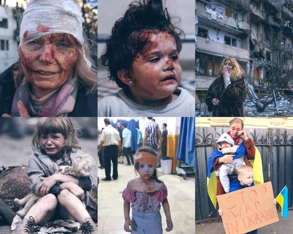AjayKumarUpp1's tweet photo. इन मासूमों का क्या दोष??
#please_stop_war
#putin https://t.co/7puzPggljX