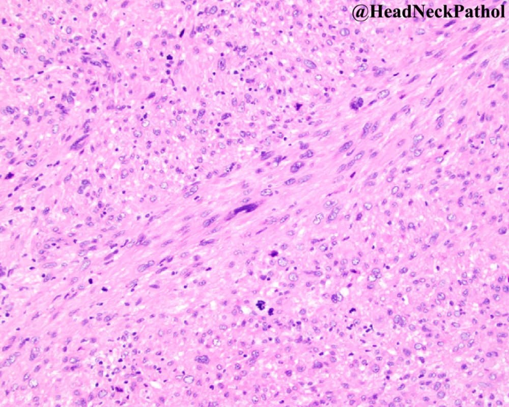 HeadNeckPathol tweet picture