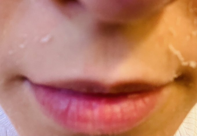 Me estoy pelando como un lagarto. As&iacute; que habr&aacute; stream sin cam hoy.   Nos vemos m&aacute;s tarde en twitch💙  Os<a href="/tag/fallguys"class="tags"><span>#fallguys</span></a>