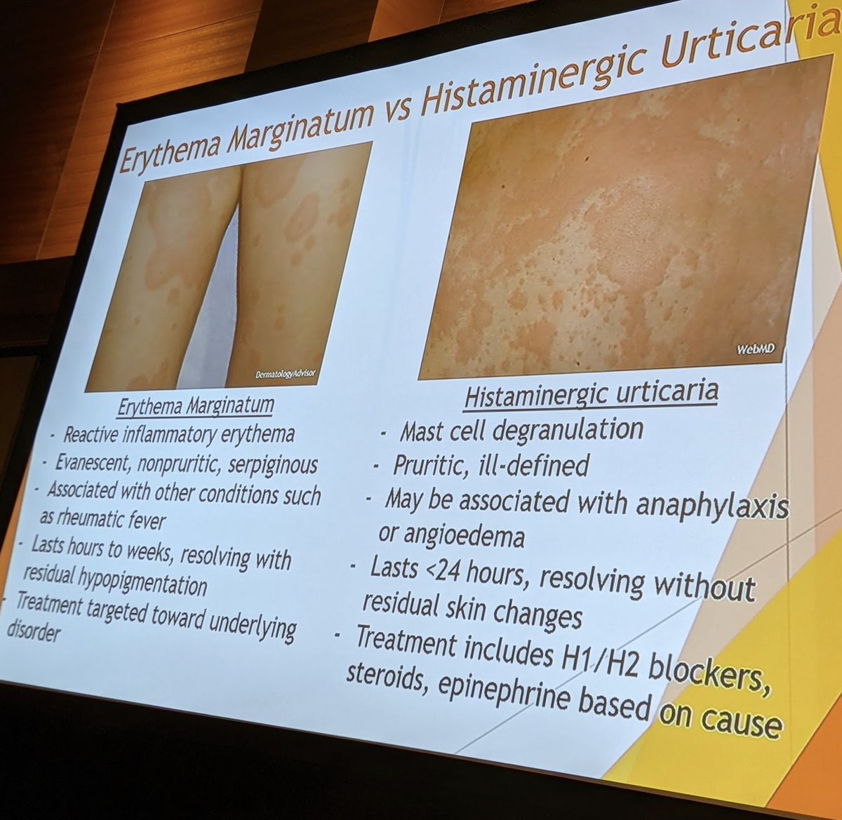 Aleena Banerji, MD (@aleenabanerjimd) on Twitter photo Nice summary slide from #AAAAI22 comparing erythema marginatum (rash seen in #HAE) vs. histaminergic #urticaria which can sometimes be confusing on clinical presentation <a href="/NeelamPhadkeMD/">Neelam Phadke</a> Nice summary slide from #AAAAI22 comparing erythema marginatum (rash seen in #HAE) vs. histaminergic #urticaria which can sometimes be confusing on clinical presentation <a href="/NeelamPhadkeMD/">Neelam Phadke</a>