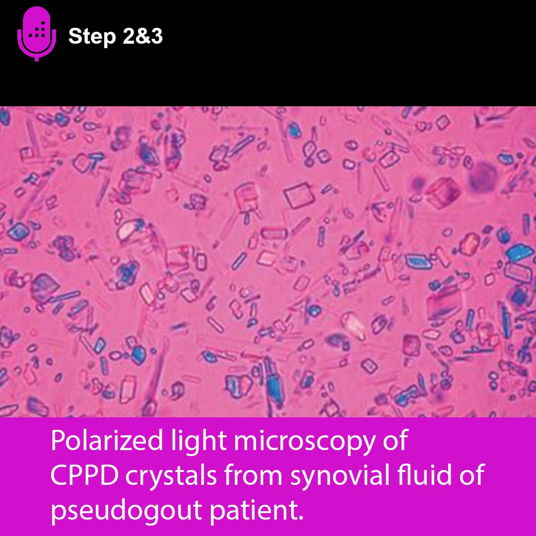 Cannot Access Java Lang String Class Cppd Crystals In Synovial Fluid
